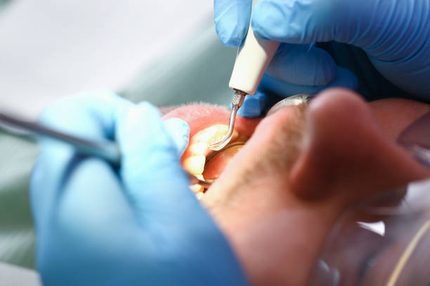 Best Emergency Wisdom Teeth Removal in Munday, TX
